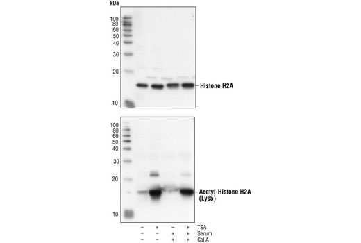 Western Blotting Image 1: Histone H2A Antibody II