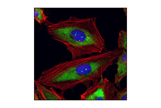 Immunofluorescence Image 1: Ribosomal Protein S3 Antibody