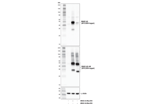 Western Blotting Image 2: MAGE-A3 Antibody