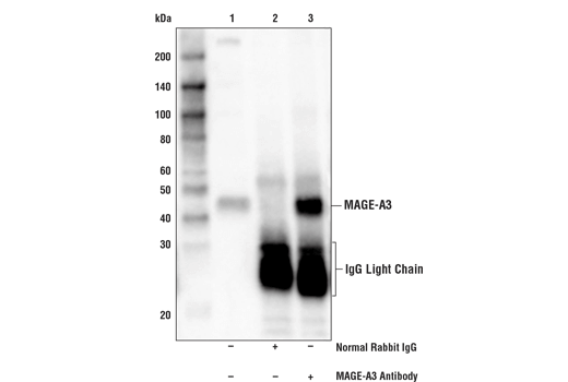 Immunoprecipitation Image 1: MAGE-A3 Antibody