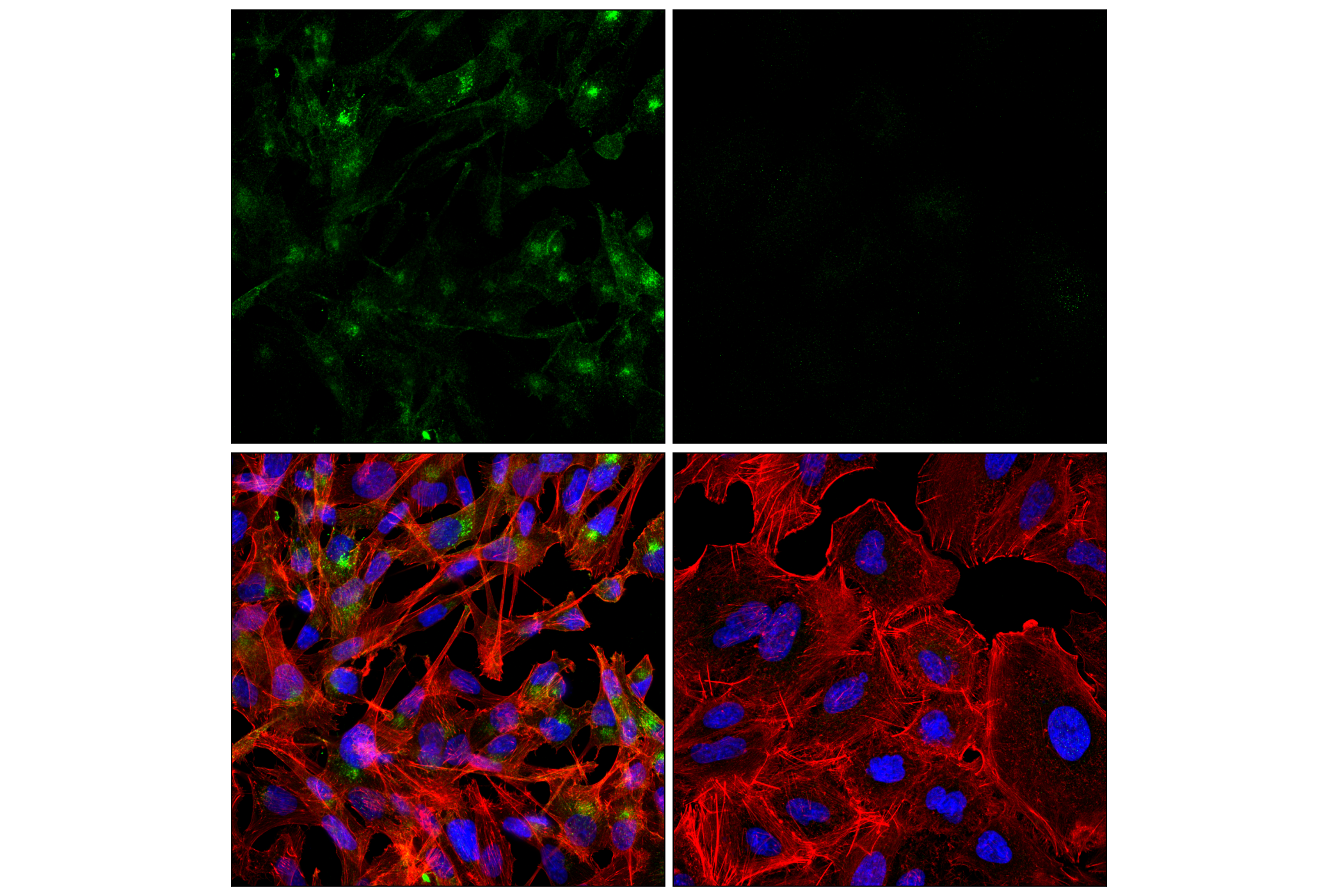 Immunofluorescence Image 1: DDR2 (E6V2N) Rabbit mAb