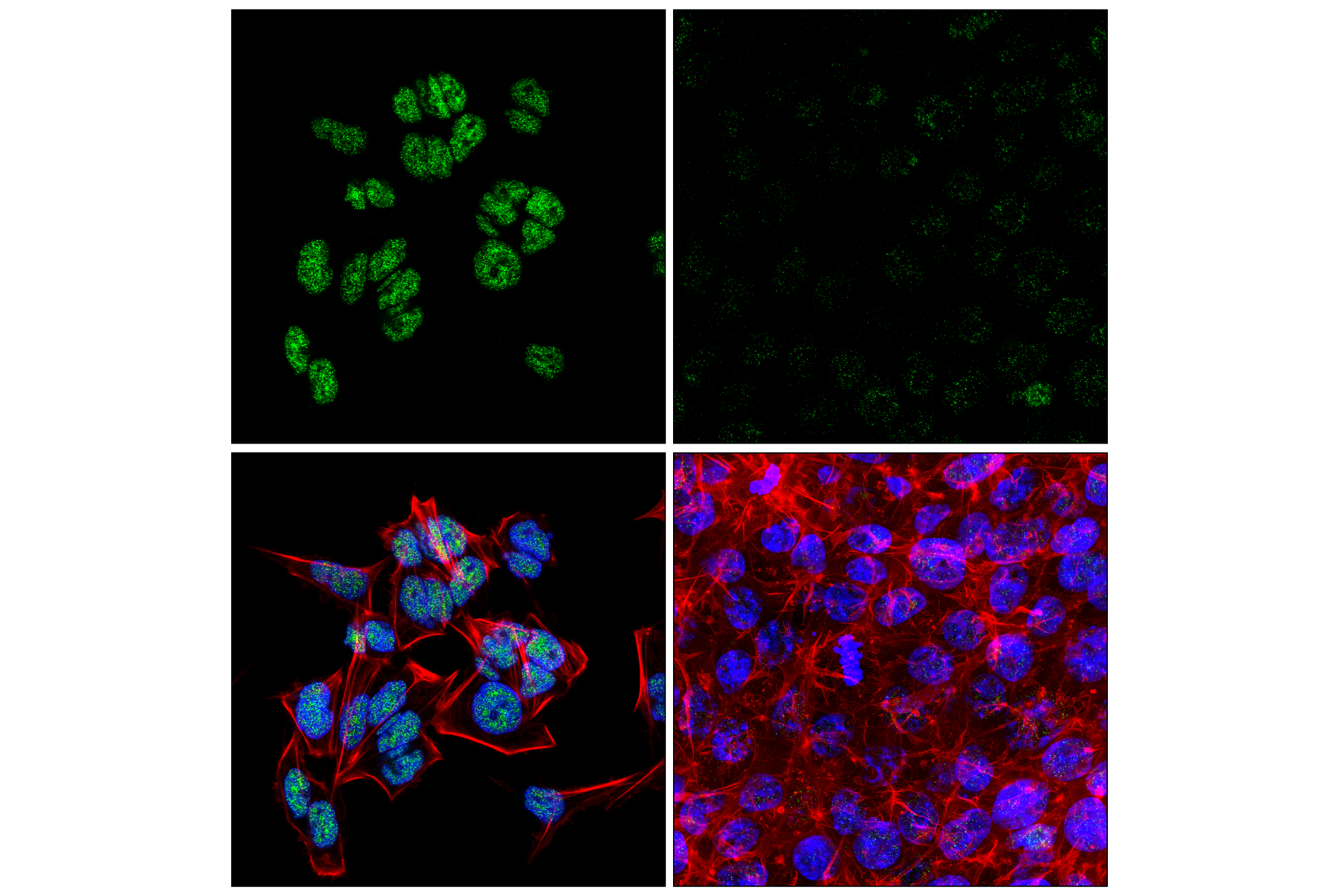 Immunofluorescence Image 1: FoxK1 (E4D1V) Rabbit mAb