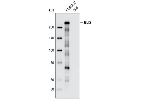 Western Blotting Image 1: GLI2 (R770) Antibody