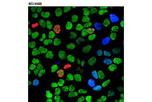 Immunofluorescence Image 1: PCNA (PC10) Mouse mAb