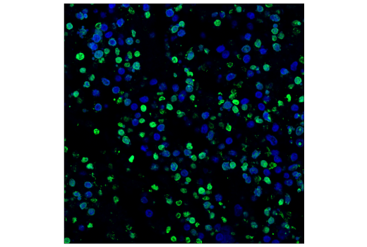 Immunohistochemistry Image 2: TUNEL Assay Kit (Fluorescence, 488 nm)