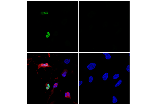 Immunofluorescence Image 2: TUNEL Assay Kit (Fluorescence, 488 nm)