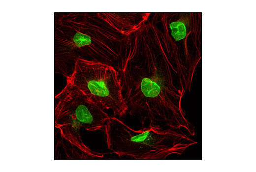 Immunofluorescence Image 1: NUP98 (C39A3) Rabbit mAb