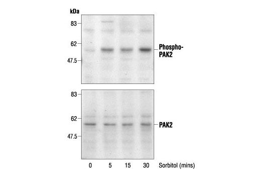 Western Blotting Image 2: Phospho-PAK1 (Thr423)/PAK2 (Thr402) Antibody