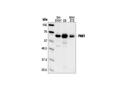 Western Blotting Image 1: PAK1 Antibody