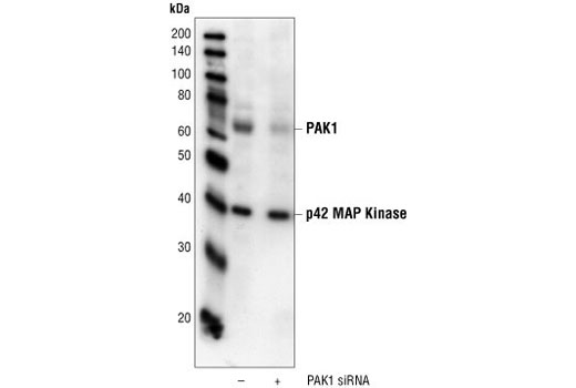 Western Blotting Image 2: PAK1 Antibody