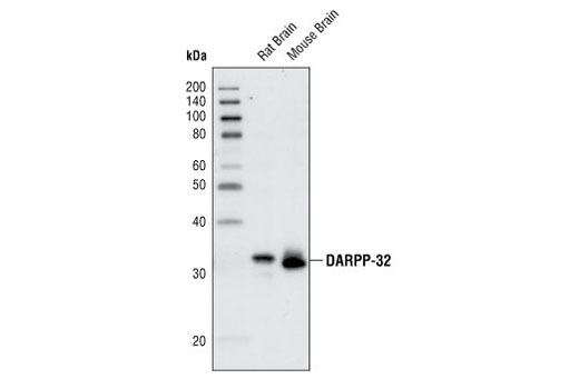 Western Blotting Image 1: DARPP-32 (19A3) Rabbit mAb (BSA and Azide Free)