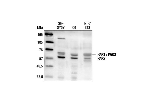 Western Blotting Image 1: PAK1/2/3 Antibody