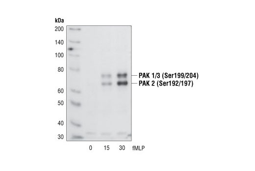 Western Blotting Image 1: Phospho-PAK1 (Ser199/204)/PAK2 (Ser192/197) Antibody