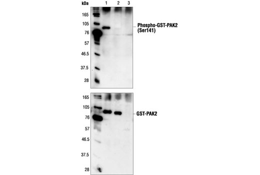 Western Blotting Image 1: Phospho-PAK1 (Ser144)/PAK2 (Ser141) Antibody