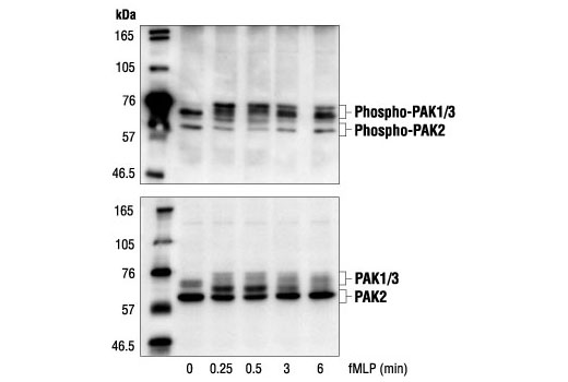 Western Blotting Image 2: Phospho-PAK1 (Ser144)/PAK2 (Ser141) Antibody