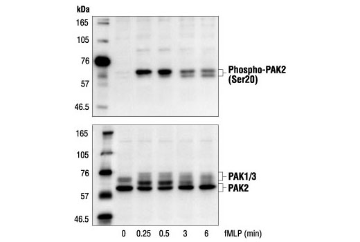 Western Blotting Image 1: Phospho-PAK2 (Ser20) Antibody