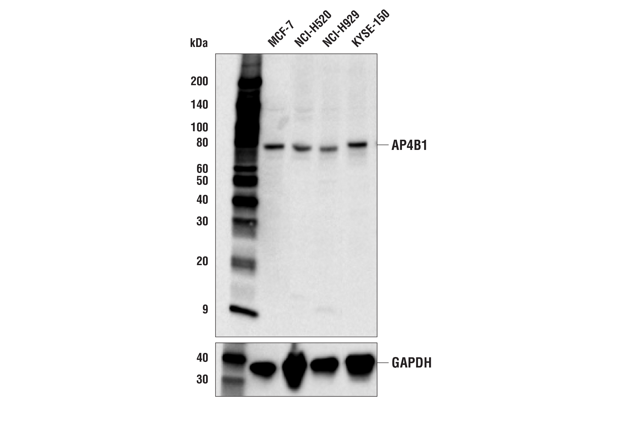 Western Blotting Image 2: AP4B1 Antibody