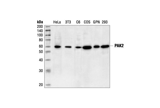 Western Blotting Image 1: PAK2 Antibody