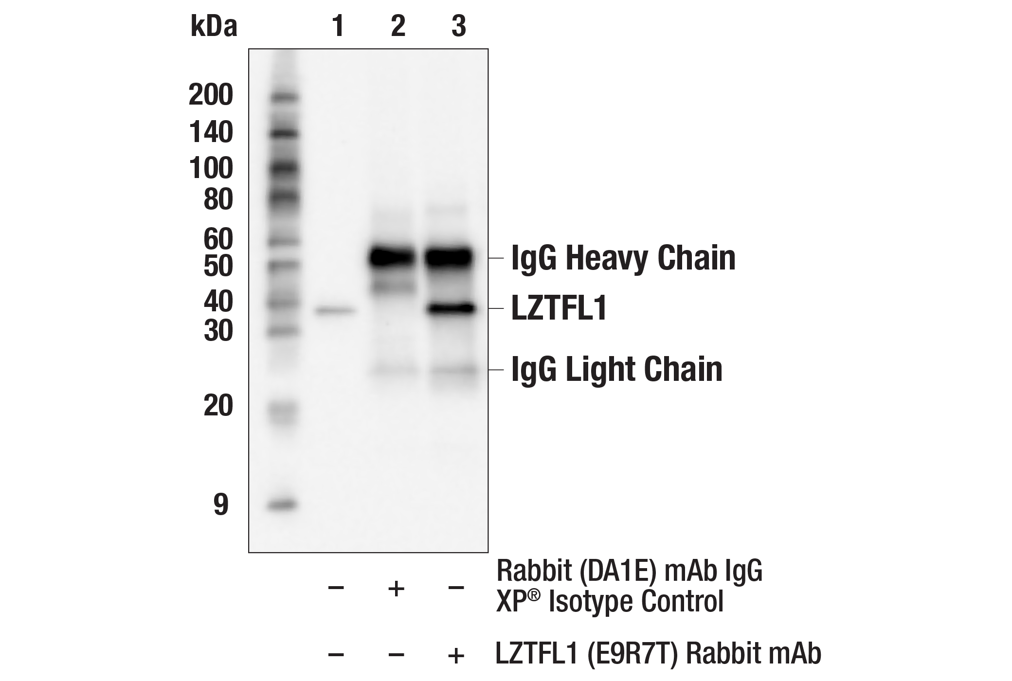 Immunoprecipitation Image 1: LZTFL1 (E9R7T) Rabbit mAb