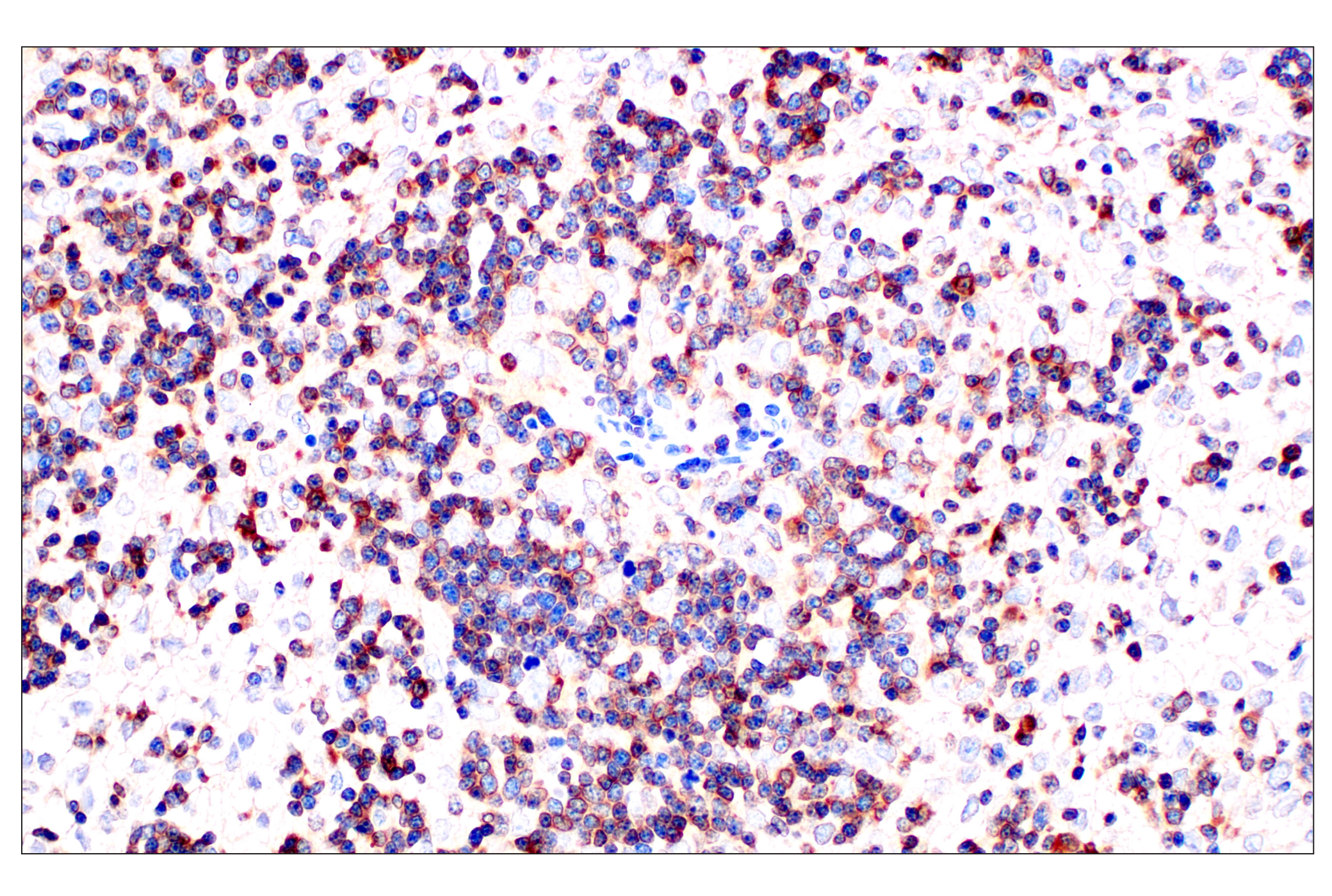 Immunohistochemistry Image 1: LZTFL1 (E9R7T) Rabbit mAb