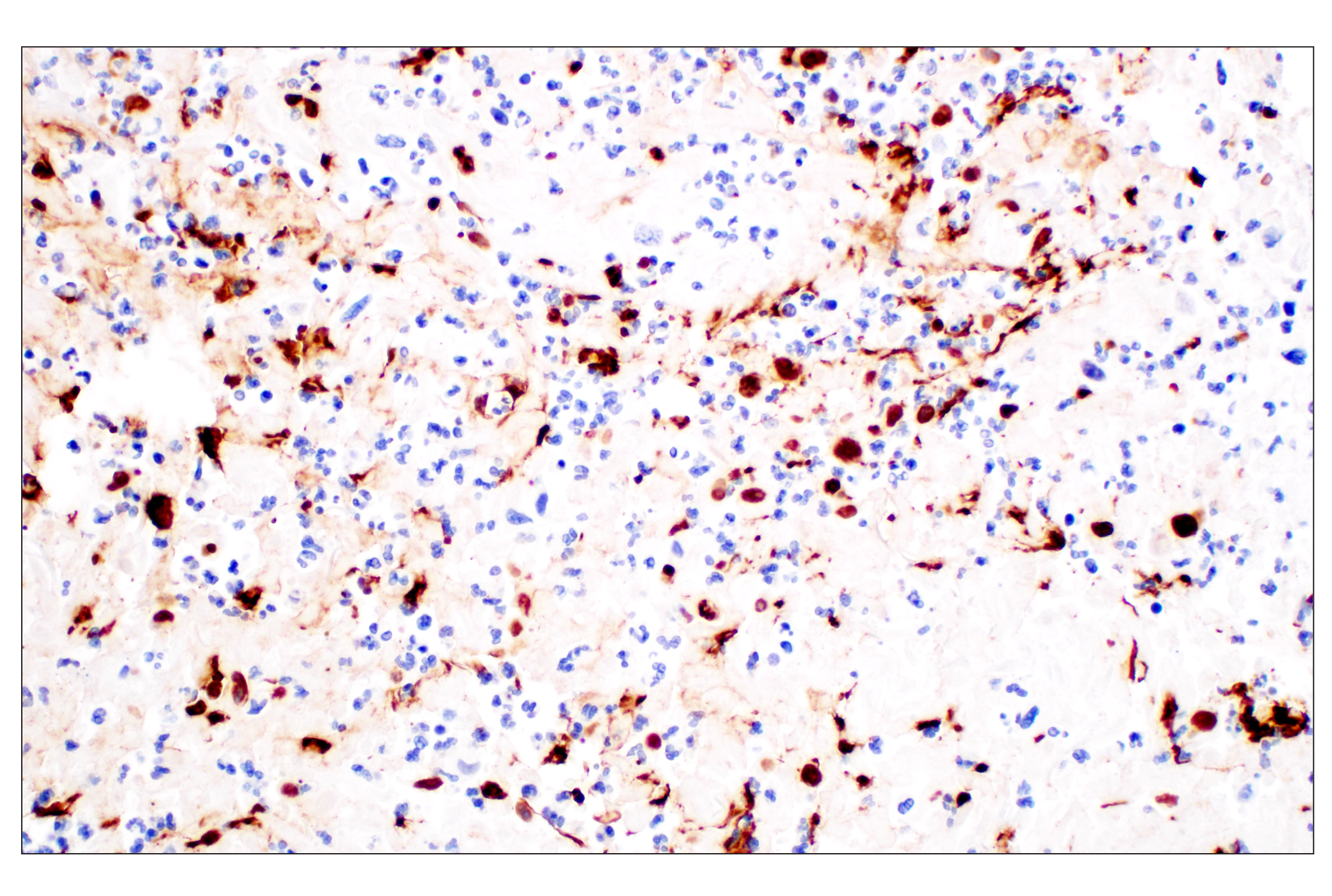 Immunohistochemistry Image 3: Citrullinated Histone H3 (Arg2) (F3C9B) Rabbit mAb (IHC Formulated)