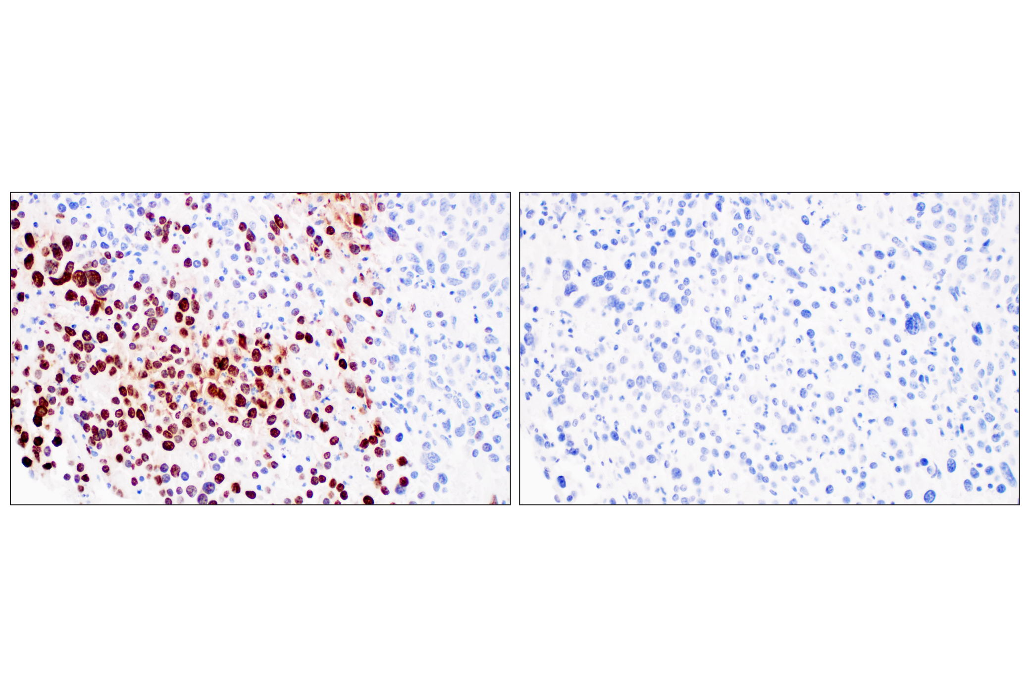 Immunohistochemistry Image 8: Citrullinated Histone H3 (Arg2) (F3C9B) Rabbit mAb (IHC Formulated)