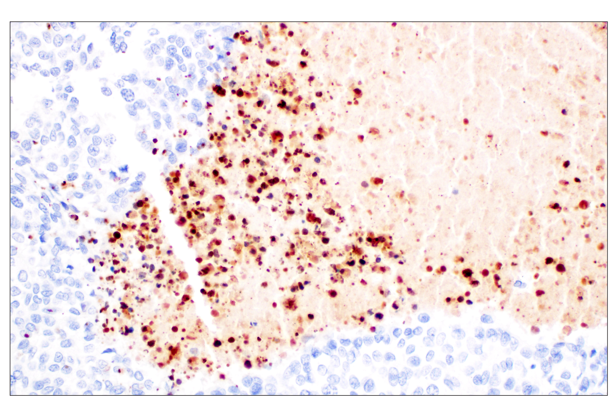 Immunohistochemistry Image 4: Citrullinated Histone H3 (Arg2) (F3C9B) Rabbit mAb (IHC Formulated)