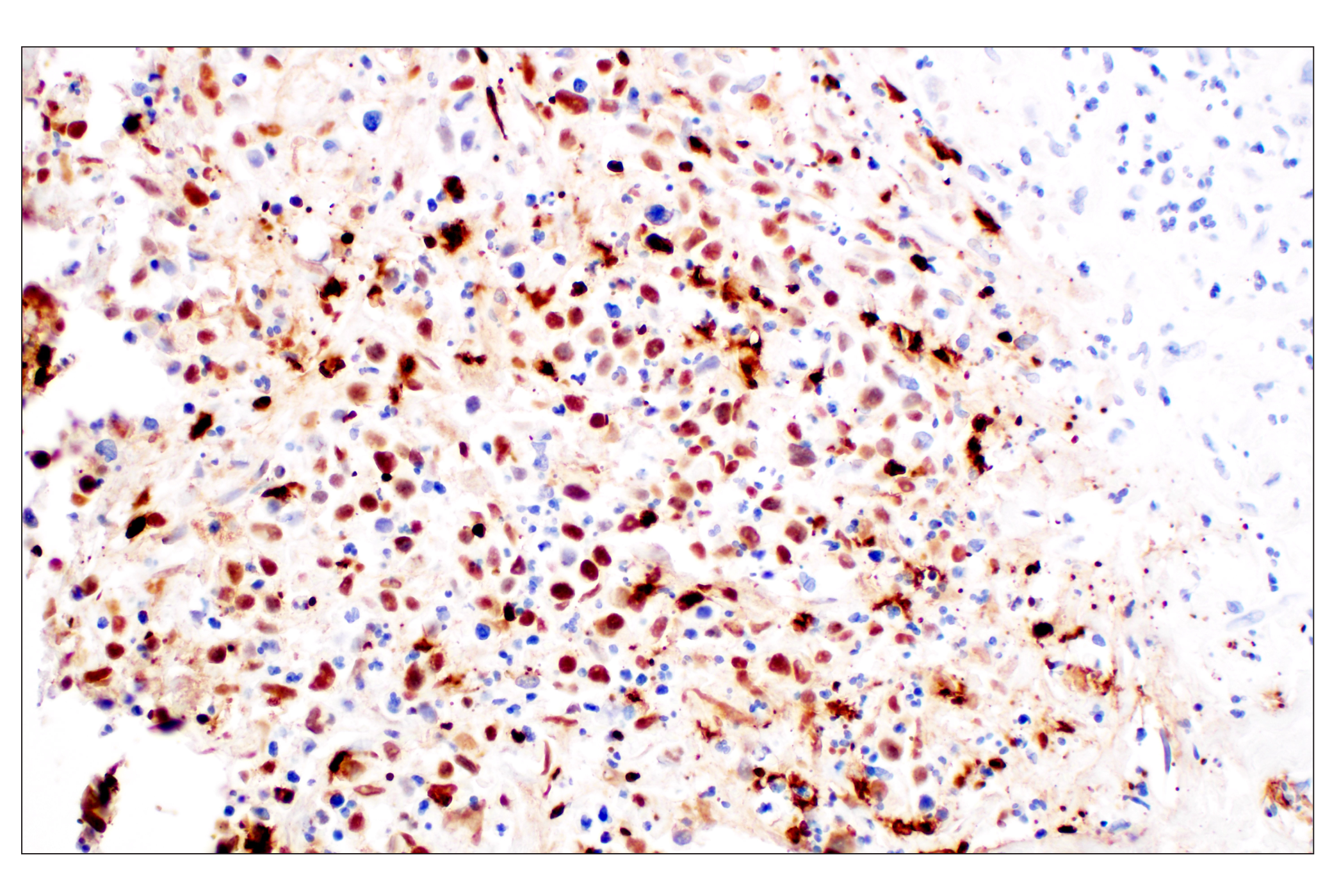 Immunohistochemistry Image 1: Citrullinated Histone H3 (Arg2) (F3C9B) Rabbit mAb (IHC Formulated)
