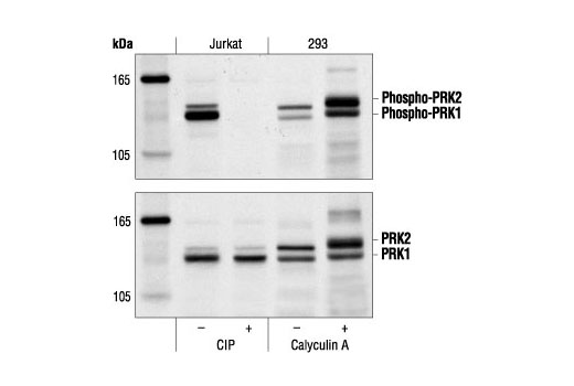 Western Blotting Image 1: Phospho-PRK1 (Thr774)/PRK2 (Thr816) Antibody
