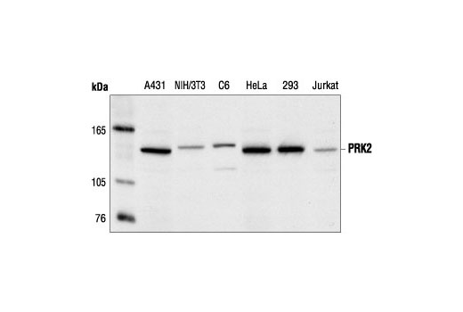Western Blotting Image 1: PRK2 Antibody