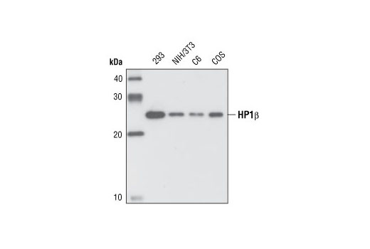 Western Blotting Image 1: HP1β Antibody