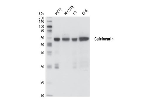 Western Blotting Image 1: Pan-Calcineurin A Antibody