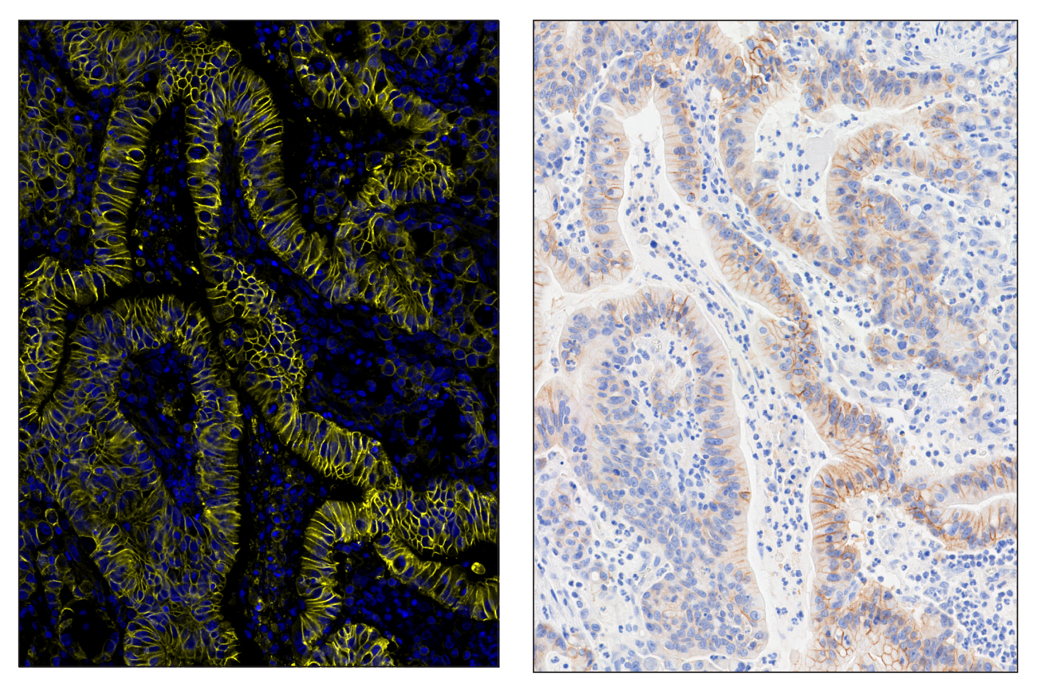 Immunohistochemistry Image 6: Na,K-ATPase α1 (D4Y7E) & CO-0079-488 SignalStar™ Oligo-Antibody Pair