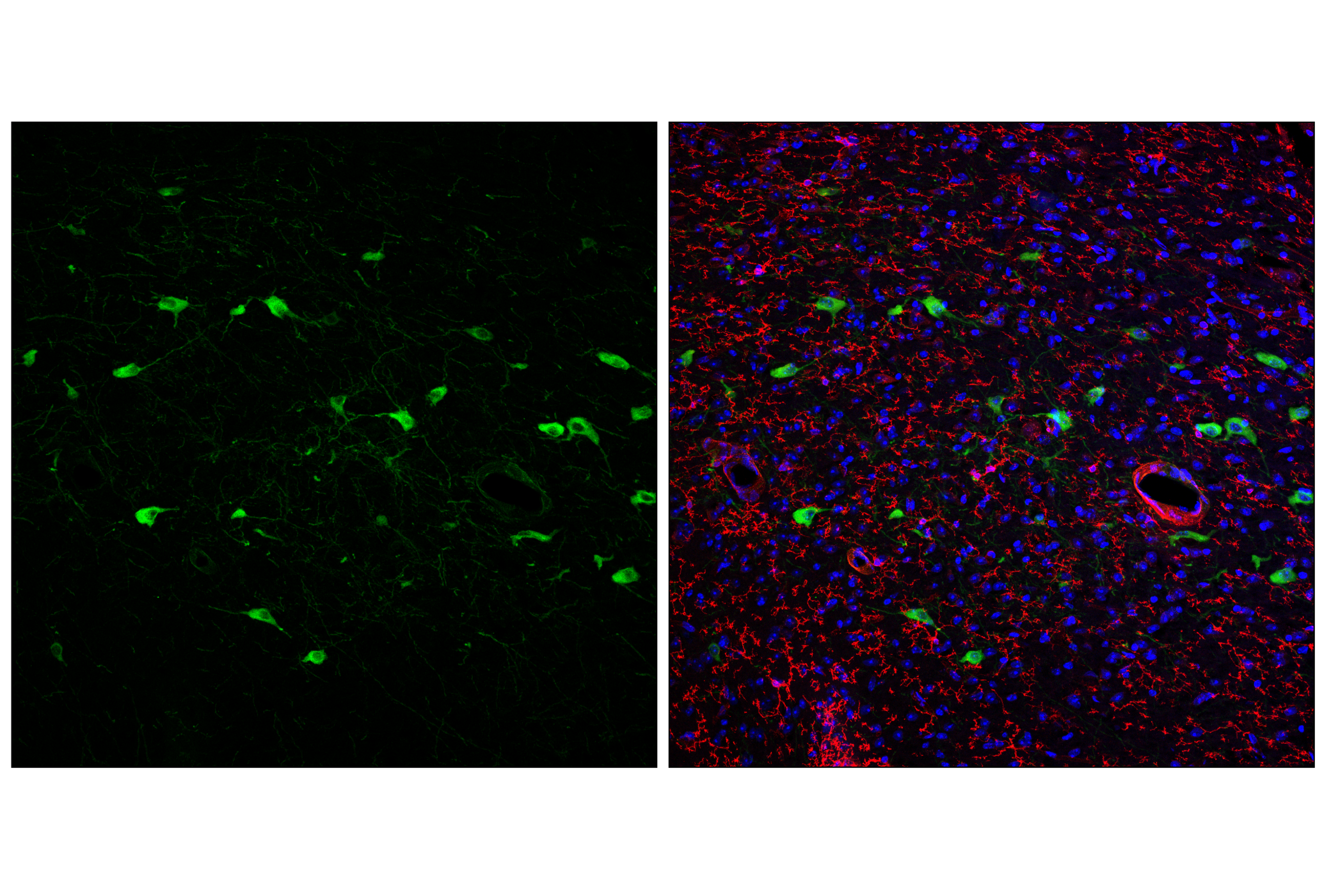 Immunofluorescence Image 1: p75NTR (F2L9S) Rabbit mAb