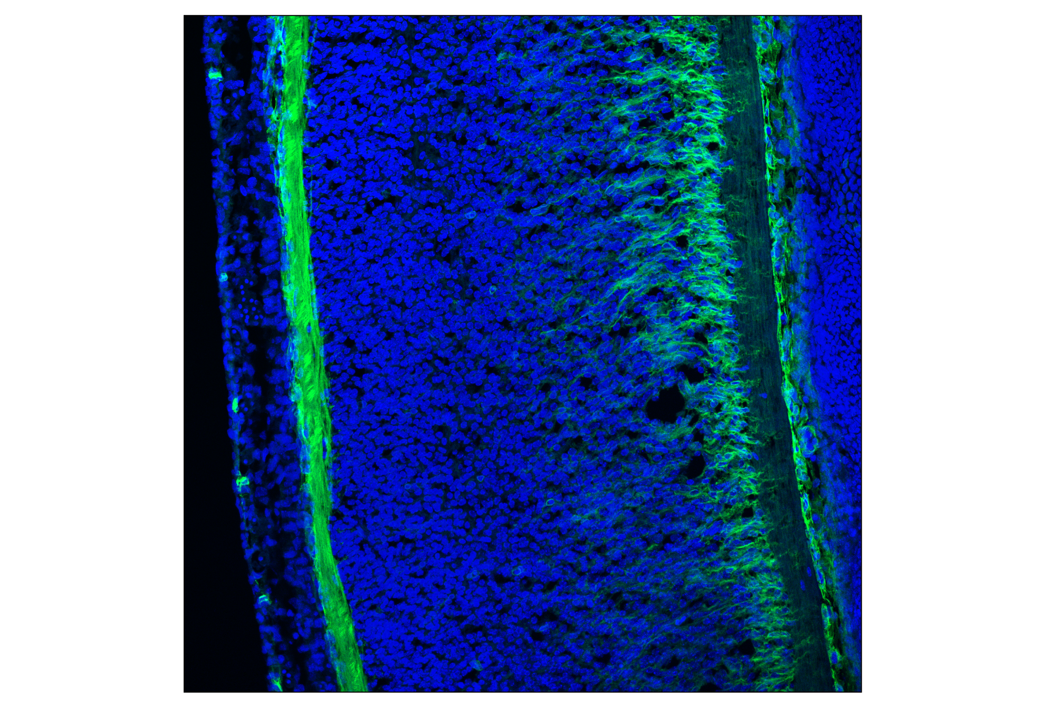 Immunofluorescence Image 3: p75NTR (F2L9S) Rabbit mAb