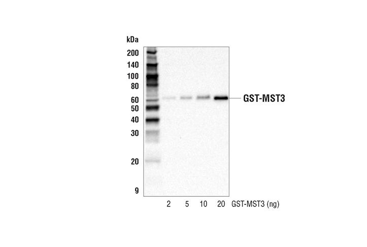 Western Blotting Image 3: GST-Tag Antibody