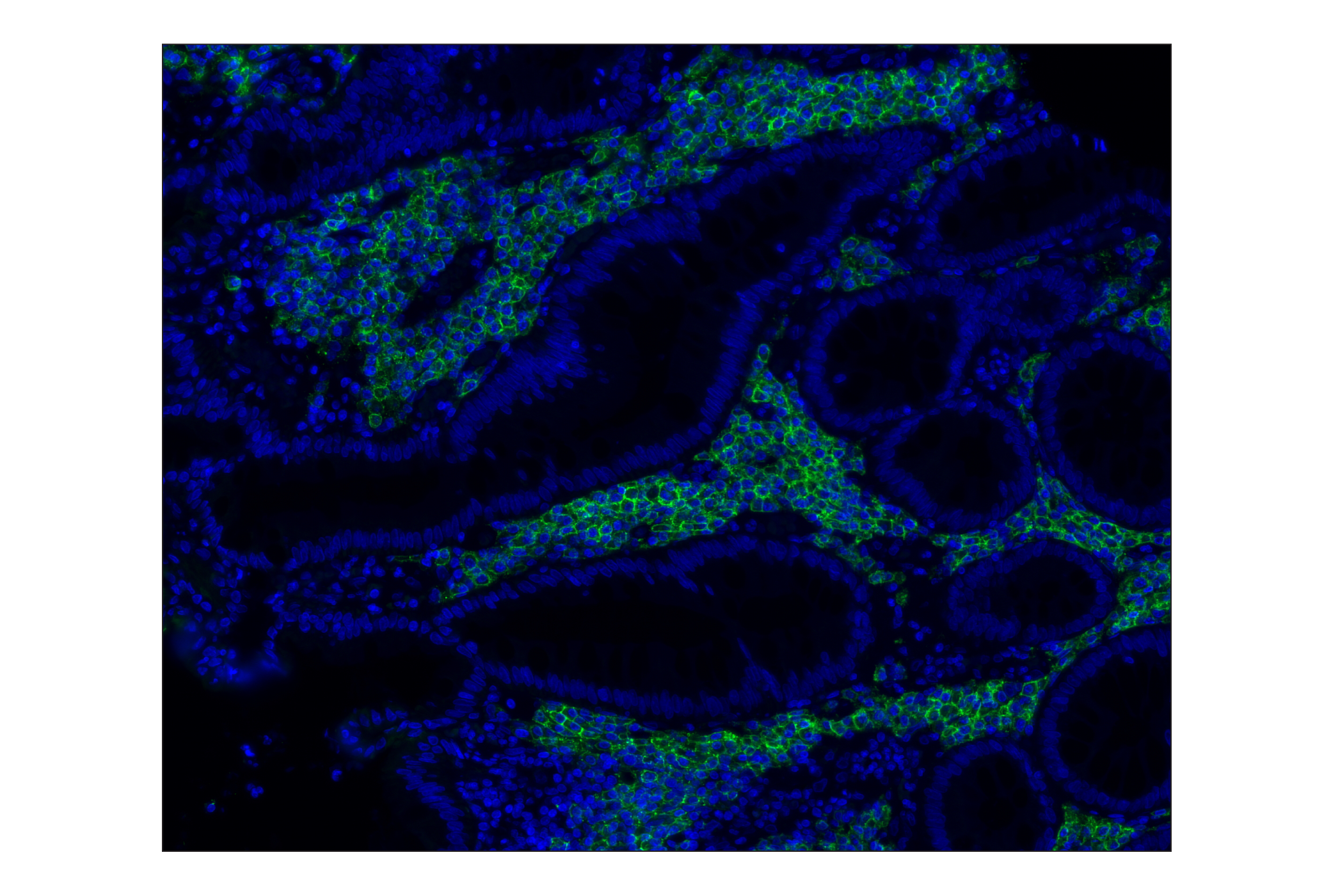 Immunohistochemistry Image 1: CD38 (E7Z8C) XP® Rabbit mAb (Alexa Fluor® 488 Conjugate)