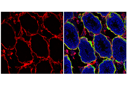Immunofluorescence Image 2: CD34 (E2J1K) Rabbit mAb (BSA and Azide Free)