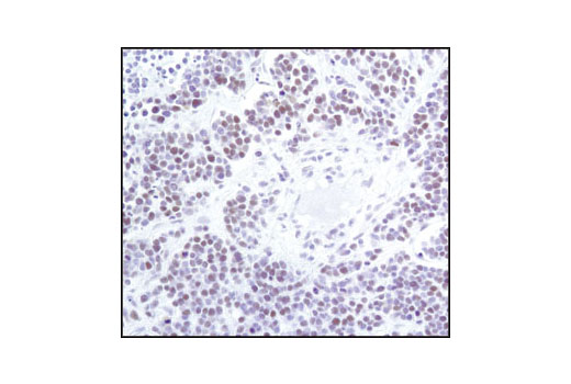 Immunohistochemistry Image 1: HP1α/β (C7F11) Rabbit mAb