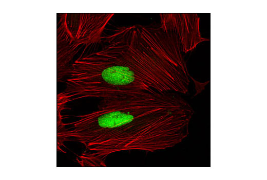 Immunofluorescence Image 1: HP1α/β (C7F11) Rabbit mAb