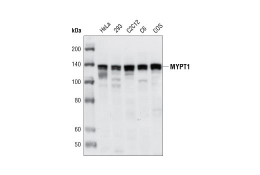 Western Blotting Image 1: MYPT1 Antibody