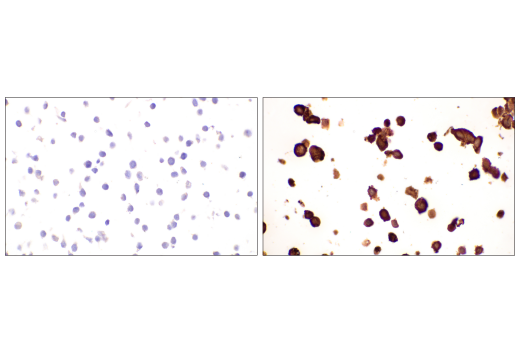 Immunohistochemistry Image 3: SARS-CoV-2 Nucleocapsid Protein (HL344) Rabbit mAb