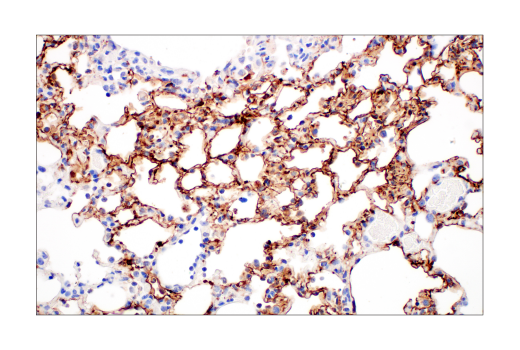 Immunohistochemistry Image 5: SARS-CoV-2 Nucleocapsid Protein (HL344) Rabbit mAb