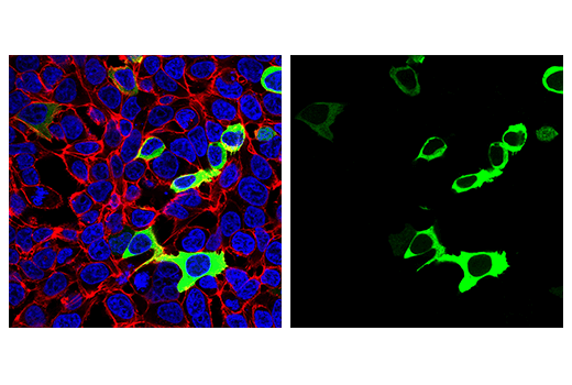 Immunofluorescence Image 1: SARS-CoV-2 Nucleocapsid Protein (HL344) Rabbit mAb