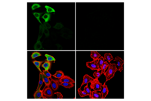 Immunofluorescence Image 2: SARS-CoV-2 Nucleocapsid Protein (HL344) Rabbit mAb