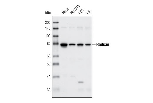 Western Blotting Image 1: Radixin (C4G7) Rabbit mAb
