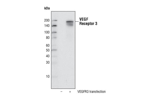 Western Blotting Image 1: VEGF Receptor 3 (C28G5) Rabbit mAb
