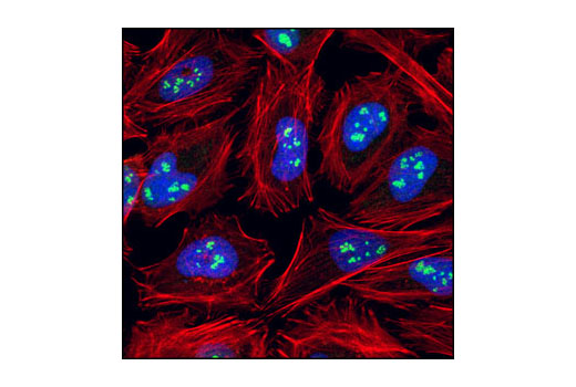 Immunofluorescence Image 3: Fibrillarin (C13C3) Rabbit mAb