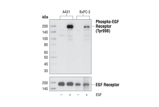 Western Blotting Image 1: Phospho-EGF Receptor (Tyr998) (C24A5) Rabbit mAb