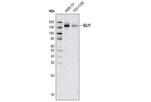 Western Blotting Image 1: GLI1 (L42B10) Mouse mAb